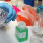 Colite ulcerosa, nuovi dati dallo studio Verdict su vedolizumab