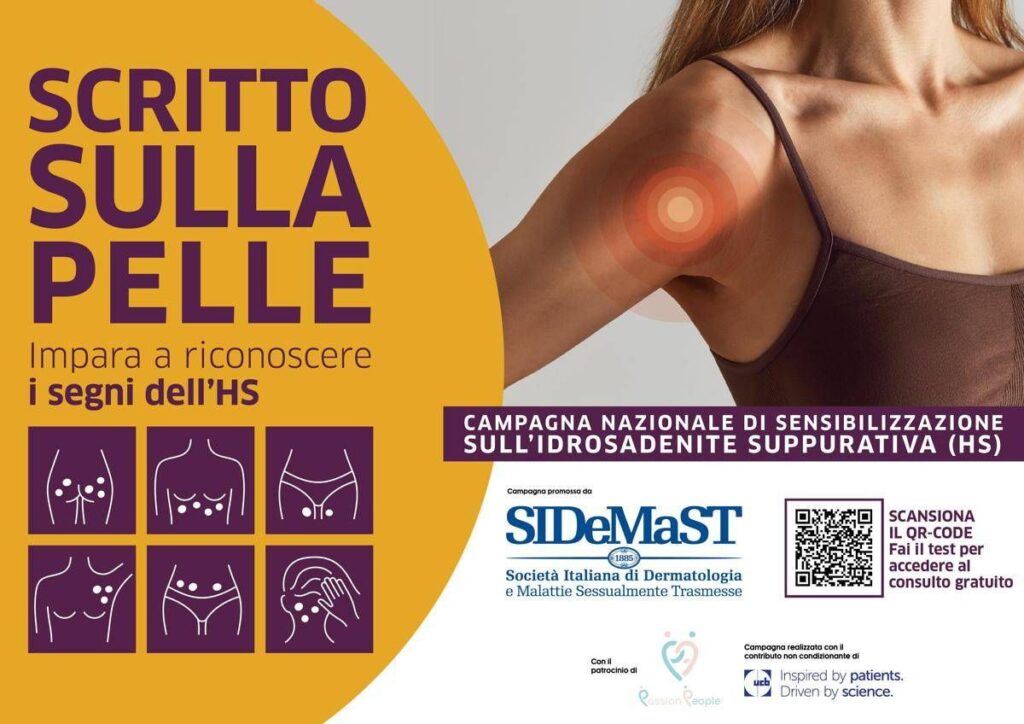 Idrosadenite suppurativa, al via campagna di sensibilizzazione ‘Scritto sulla pelle’