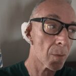 Linus ha una malattia della pelle: “Si chiama Epitelioma”. Di cosa si tratta