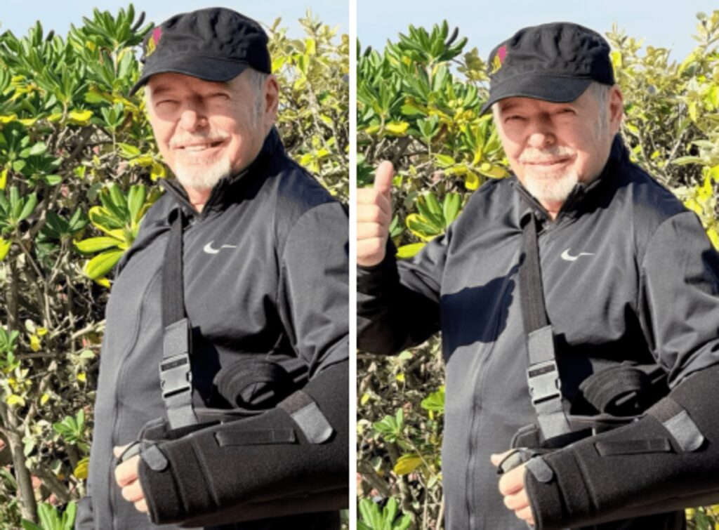 Vasco Rossi cade dalla bici e si rompe i legamenti della spalla: “Un’estate di dolori, tengo duro”