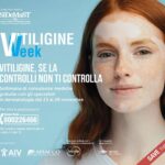 Vitiligine week, Sidemast: “Circa mille consulenze dermatologiche gratuite”
